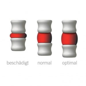 SpineMED Gerät – Abbildung 2